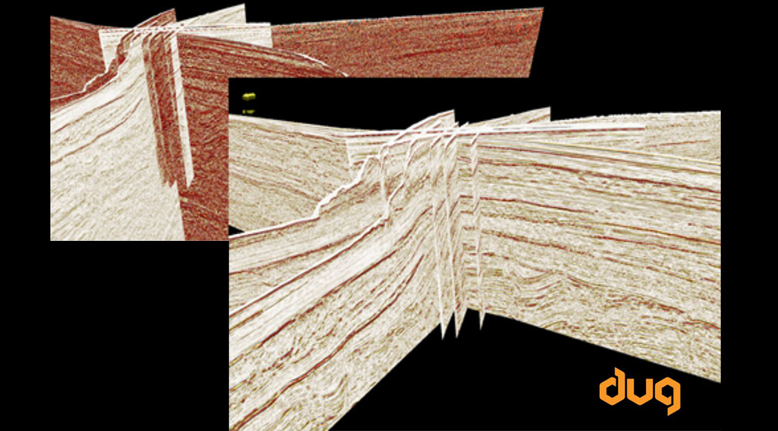 DUG Insight – Quick mistie adjustments.